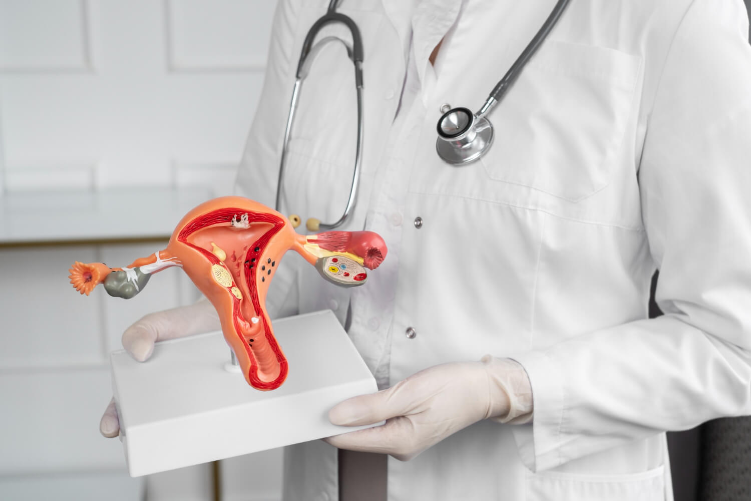 Colposcopia: O que é, como é feita e para que serve?